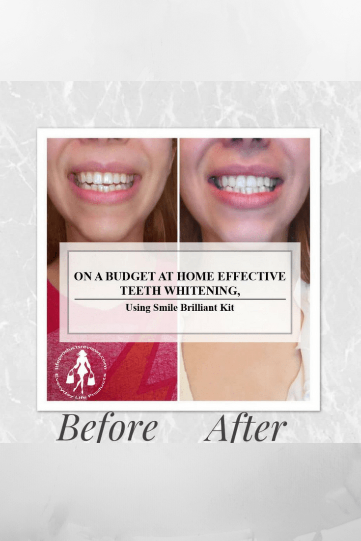 On a Budget Home Effective Teeth Whitening, Using Smile Brilliant